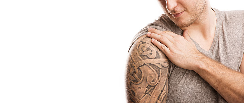 Remoção de Tatuagem