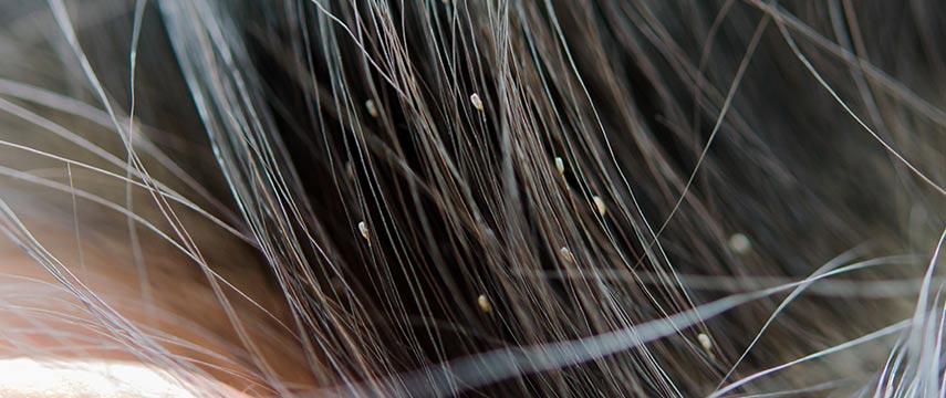 Trate piolhos de forma segura e fácil