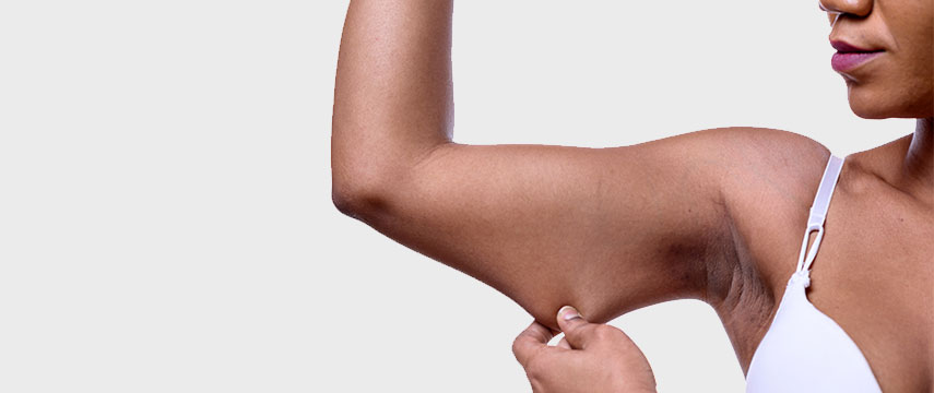 Flacidez da pele, como tratar e prevenir