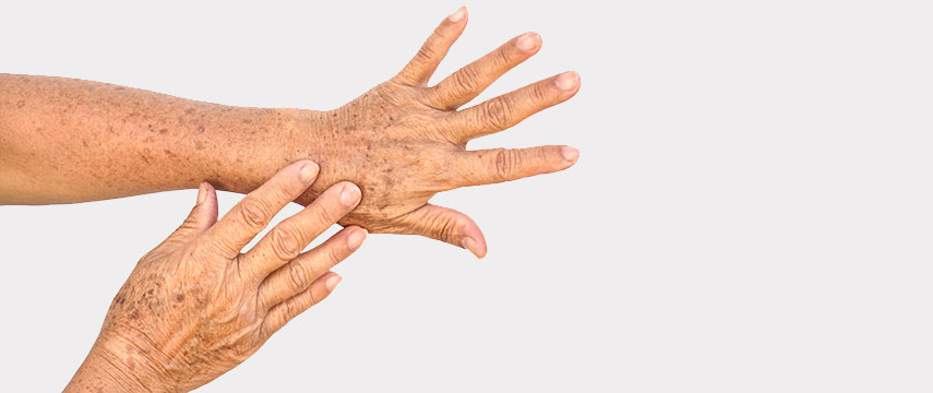 Manchas e pintas também possuem tratamento