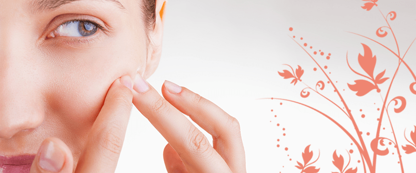 Acne na idade adulta: você não precisa conviver com ela