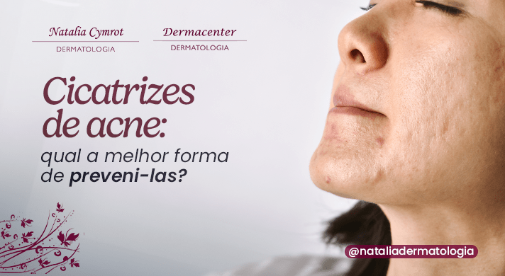 A imagem mostra uma mulher de cabelo preto com os olhos fechados, comprimindo os lábios. O rosto da mulher possui algumas acnes e cicatrizes de acne.